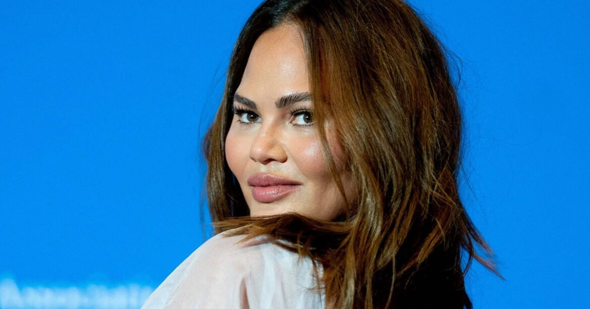 Chrissy Teigen Debunks Surrogacy Conspiracy With C-Section Photo
