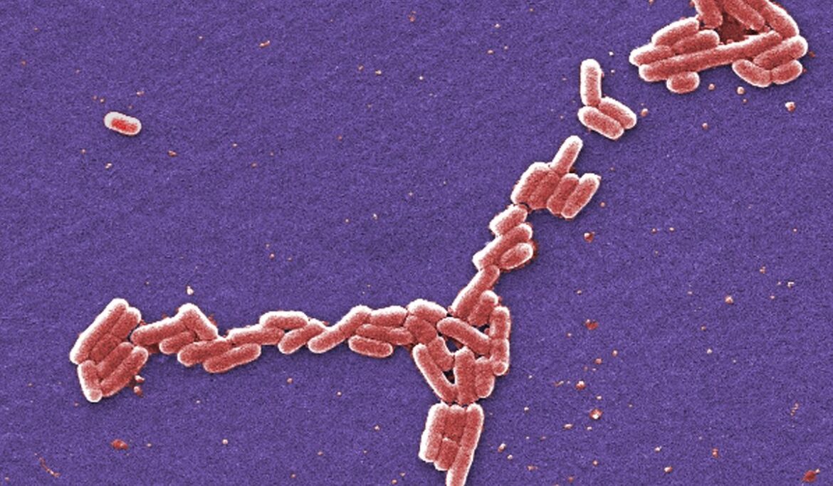 Four students hospitalized in E. coli outbreak at the University of Arkansas