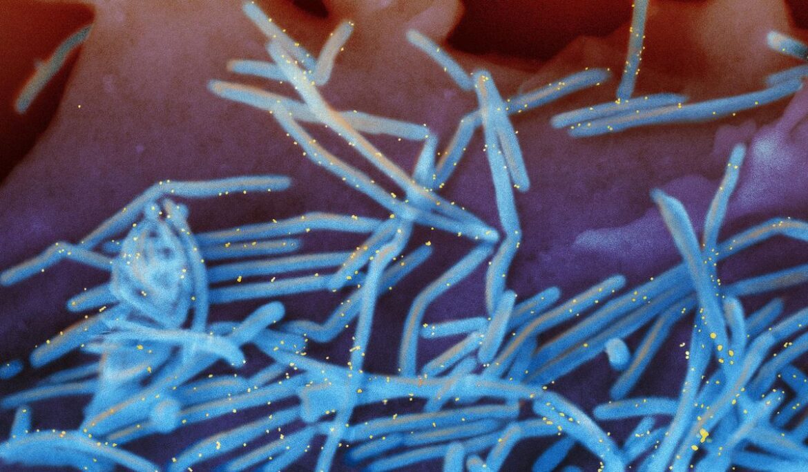 Nations combat head-scratching surge in pneumonia, respiratory disease