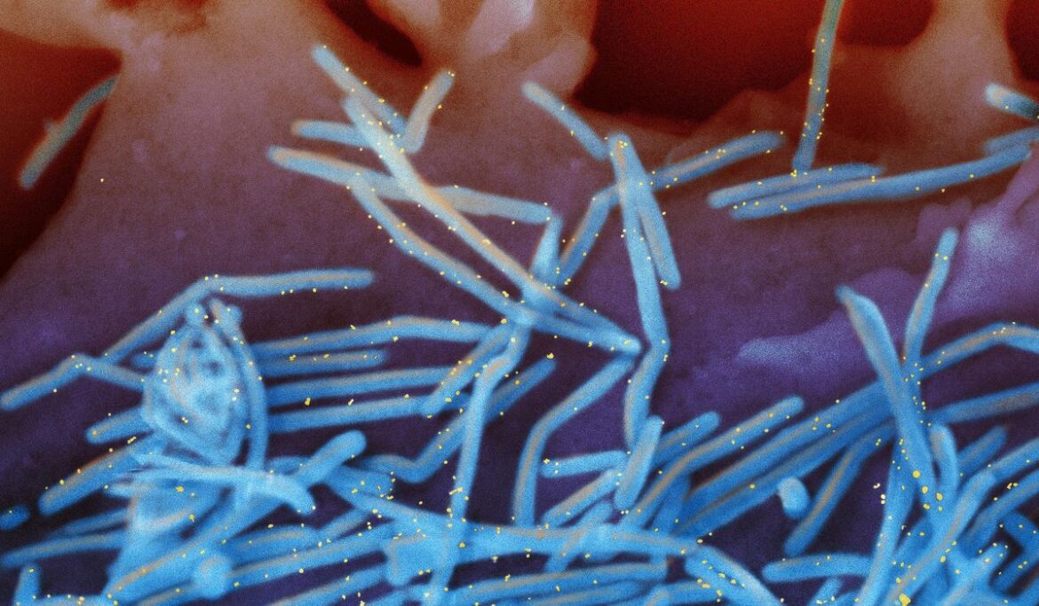 RSV is straining some hospitals, and U.S. officials are releasing more shots for newborns