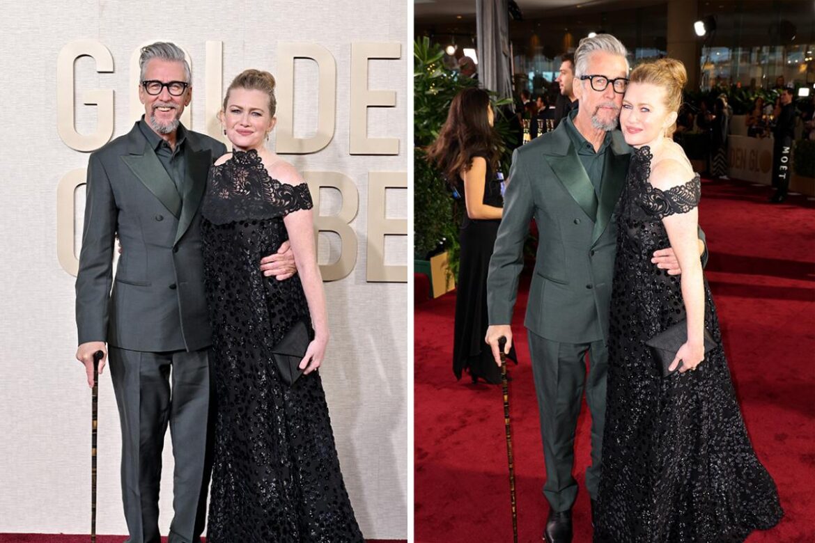 ‘Succession’s Alan Ruck Used A Cane At The 2024 Golden Globes Due To A Knee Replacement, Not His October Car Crash